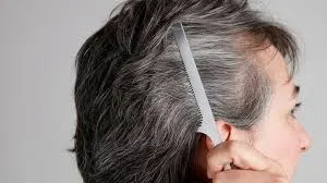 Các biện pháp tự nhiên và liệu pháp tại nhà giúp ngăn ngừa tóc bạc