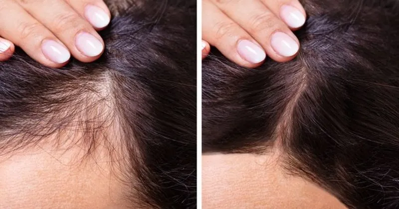 Hiểu về chu kỳ mọc tóc và những yếu tố ảnh hưởng đến tốc độ phát triển