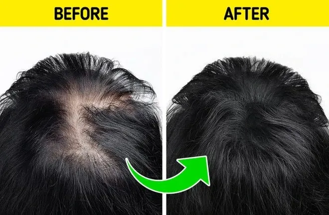 Những điều cần tránh nếu muốn tóc mọc nhanh