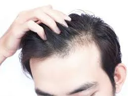 Vì sao tóc mọc chậm