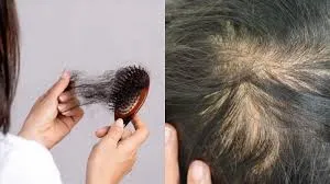 Các biện pháp tự nhiên giúp giảm tóc gãy rụng hiệu quả